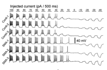 axon potentials.png
