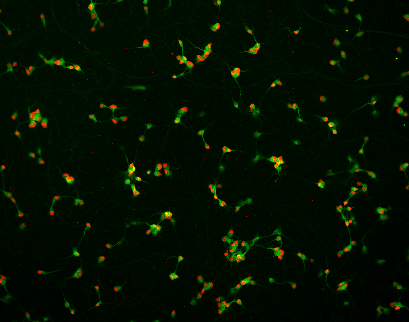 Spinal Motor Neurons — BrainXell