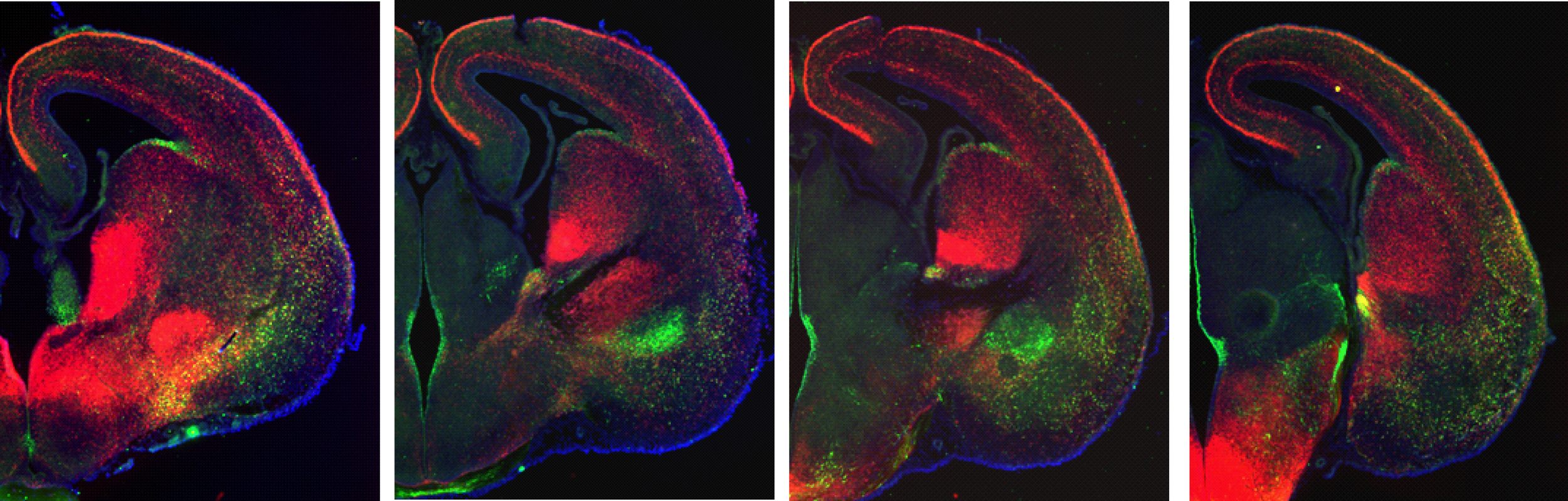 Cells in the Nkx2.1-Cre -lineage (red), somatostatin+ cells (green) and all nuclei (blue) during mid-gestation.