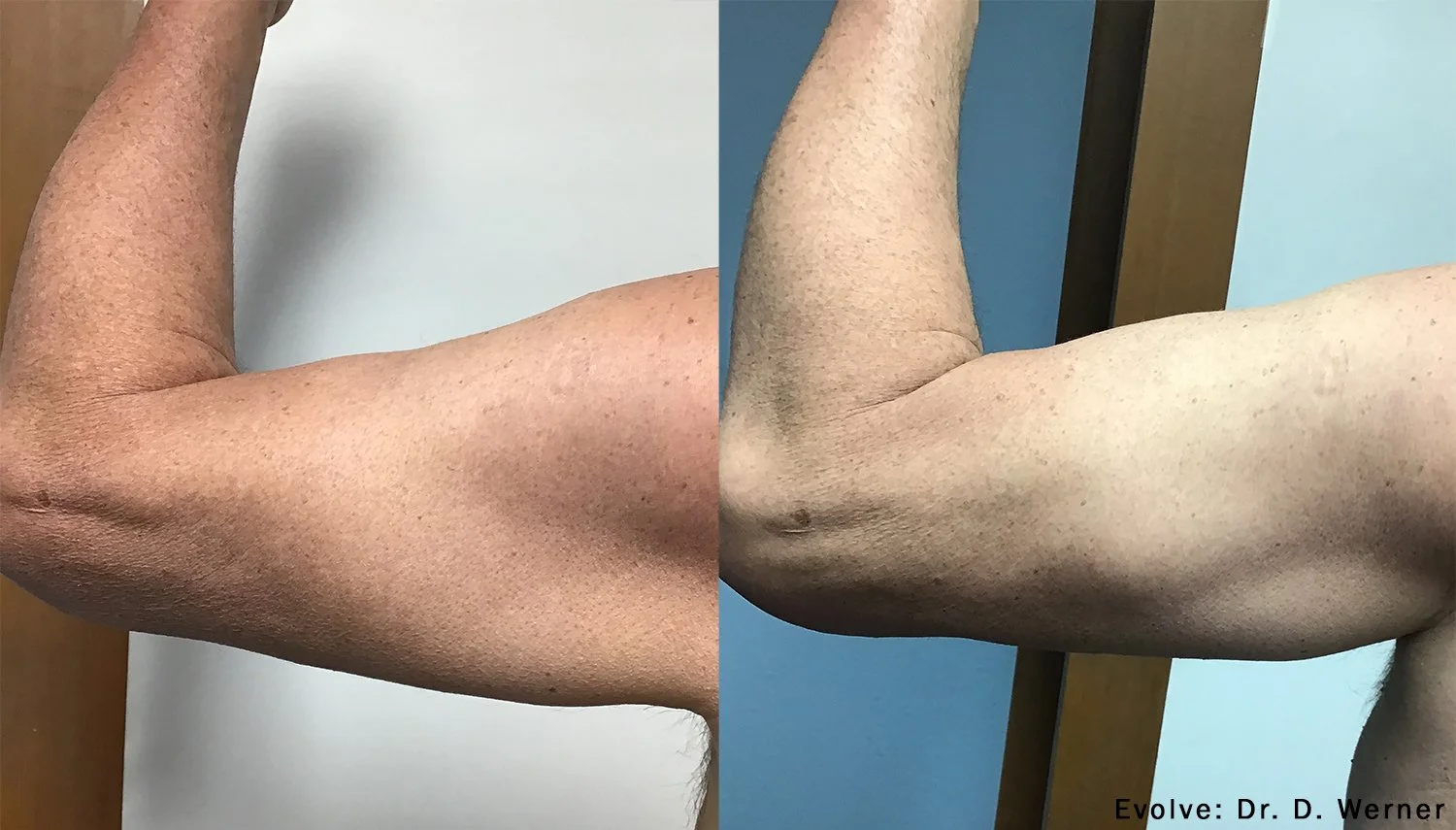 evolve-before-after-dr-d-werner-preview-1 (1).jpg
