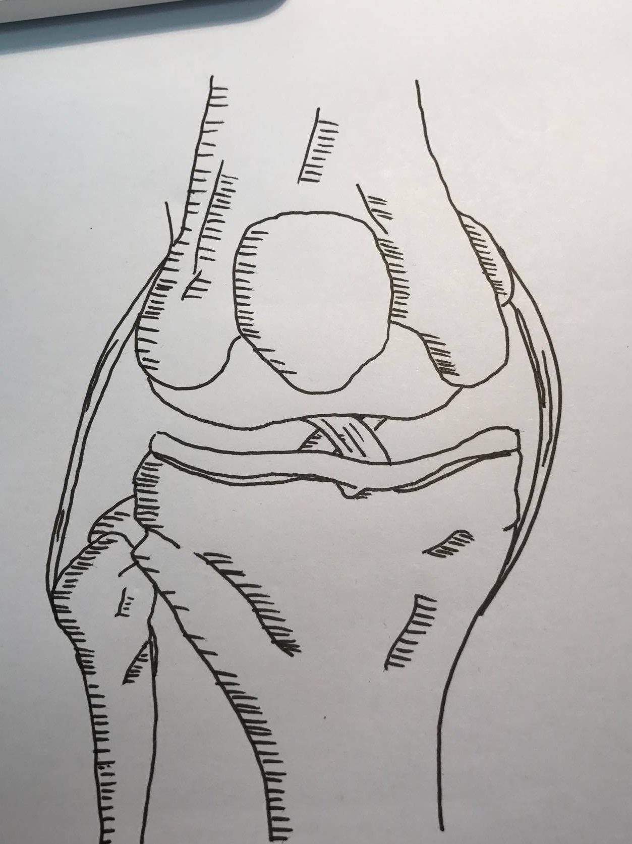 Schematic drawing of the lateral side of the knee deep to the   Download Scientific Diagram