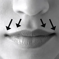upper-lip.jpg