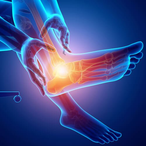 5 Simple Treatments for Sesamoiditis — Valley Stream Podiatry
