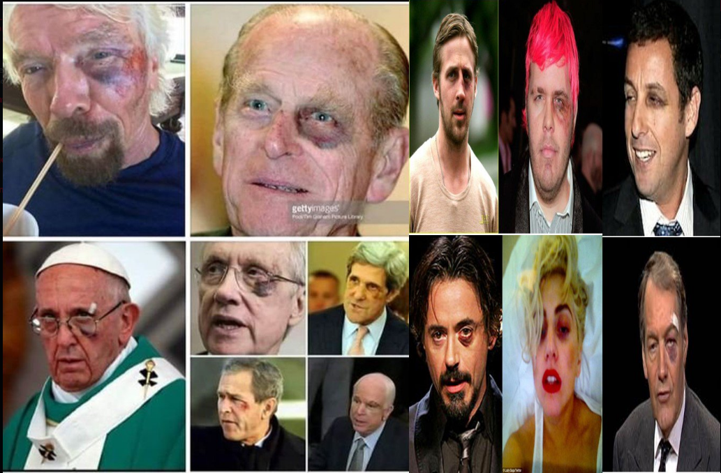 EVER WONDER WHAT THE BLACK EYE THING WAS ALL ABOUT? NOW YOU WISH YOU DIDN'T KNOW? ME TOO. :(