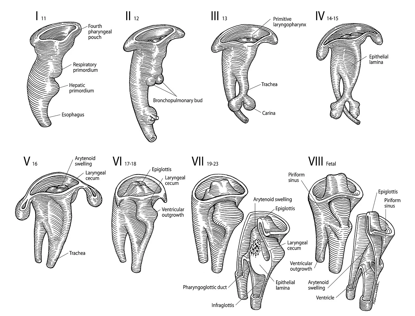 15_laryngeal_dev_1200.jpg