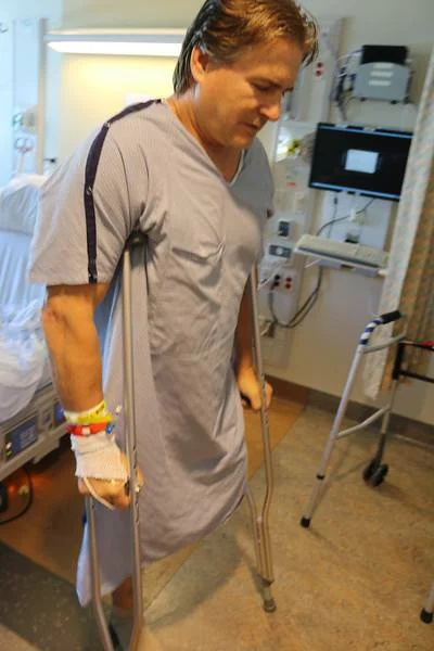 A few days after amputation. Getting use to one leg.