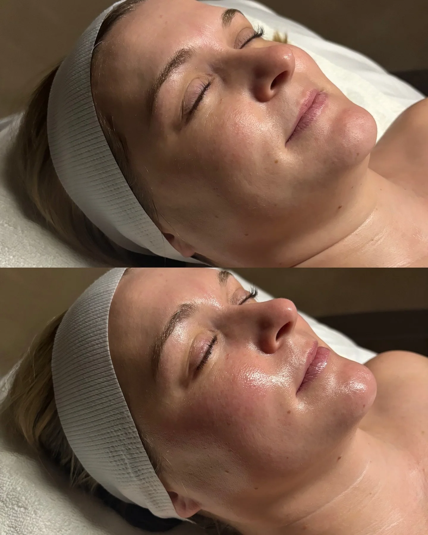 sculpt. lift. release. 

experience our buccal massage yourself ✨

📞 717.900.1390 | #BlossomYork