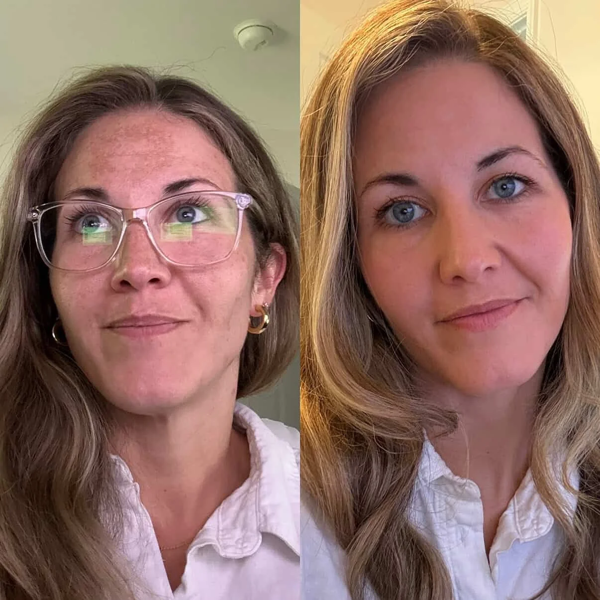 a client transformation, results so good she had to document it herself 🥹🙌🏼

these results are from our mini fraxel, a laser skin resurfacing treatment ⚡️

🧖🏼&zwj;♀️ @__madilyn__ 

📞 717.900.1390 | #BlossomYork
