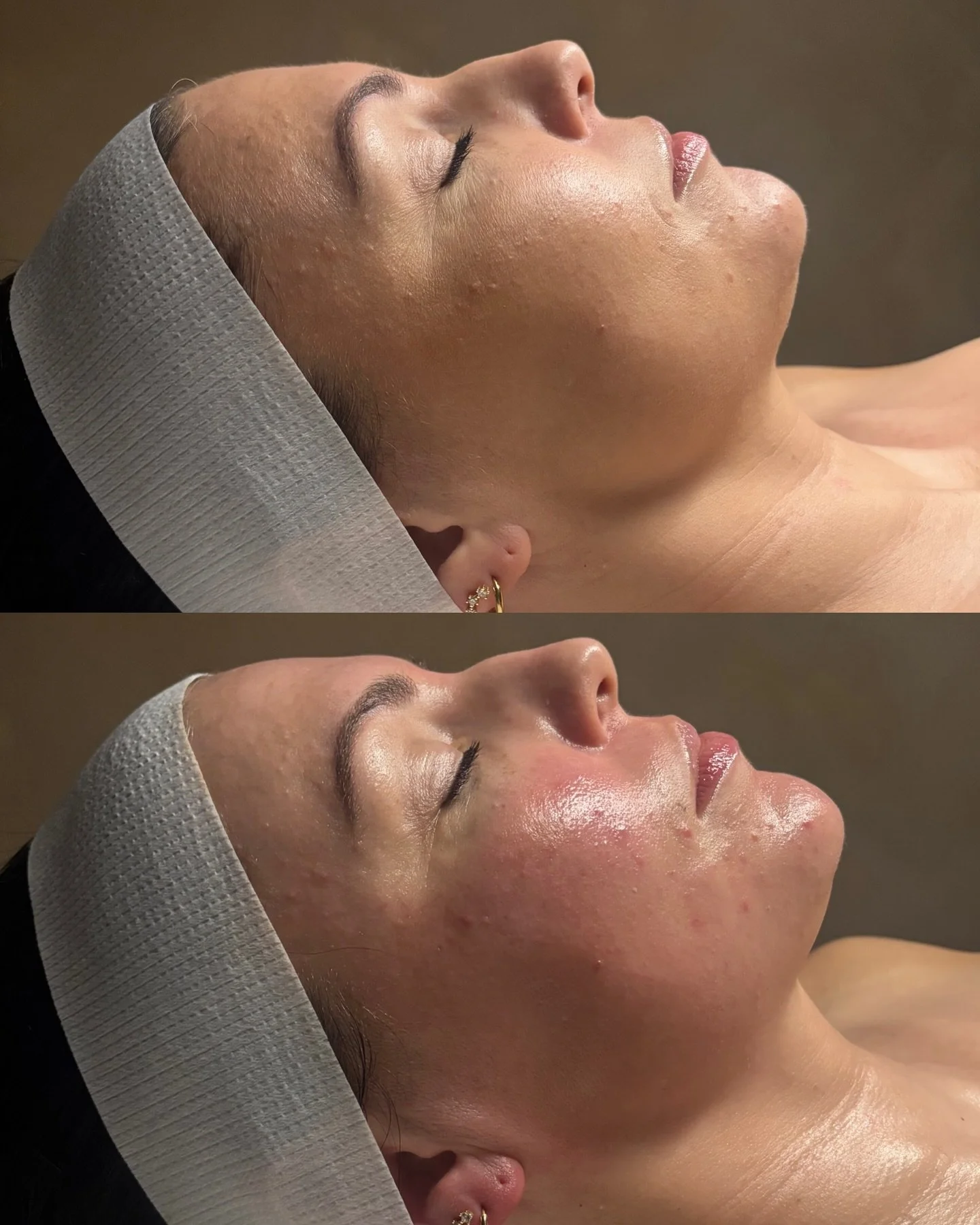 buccal massage with a dermaplane add-on ✨

🧖🏼&zwj;♀️ @__madilyn__ 

📞 717.900.1390 | #BlossomYork