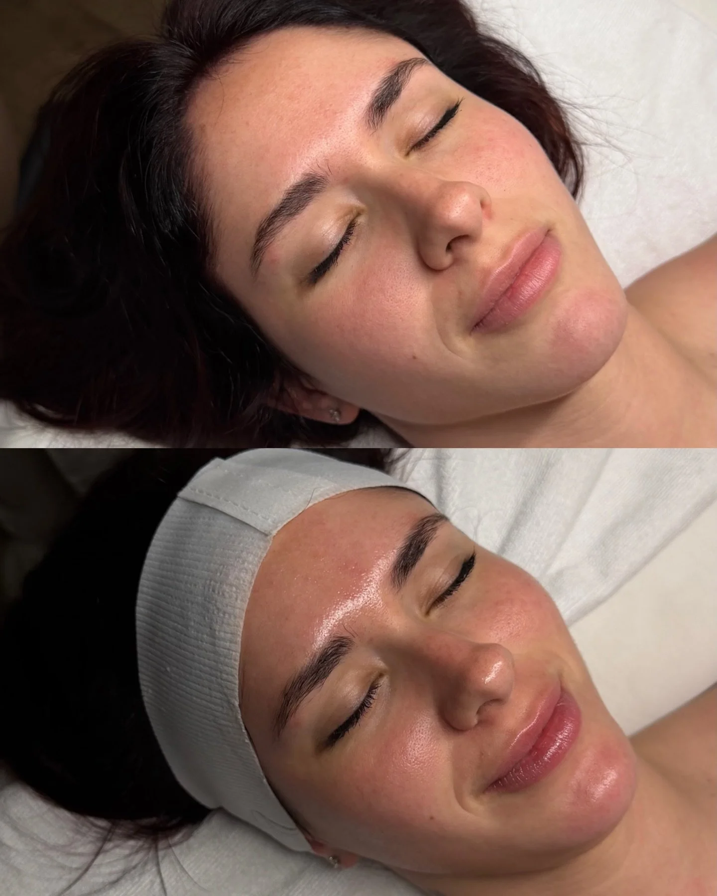 skin, softly restored 🫧

🧖🏻&zwj;♀️ @skin_byamberlynn 

📞 717.900.1390 | #BlossomYork