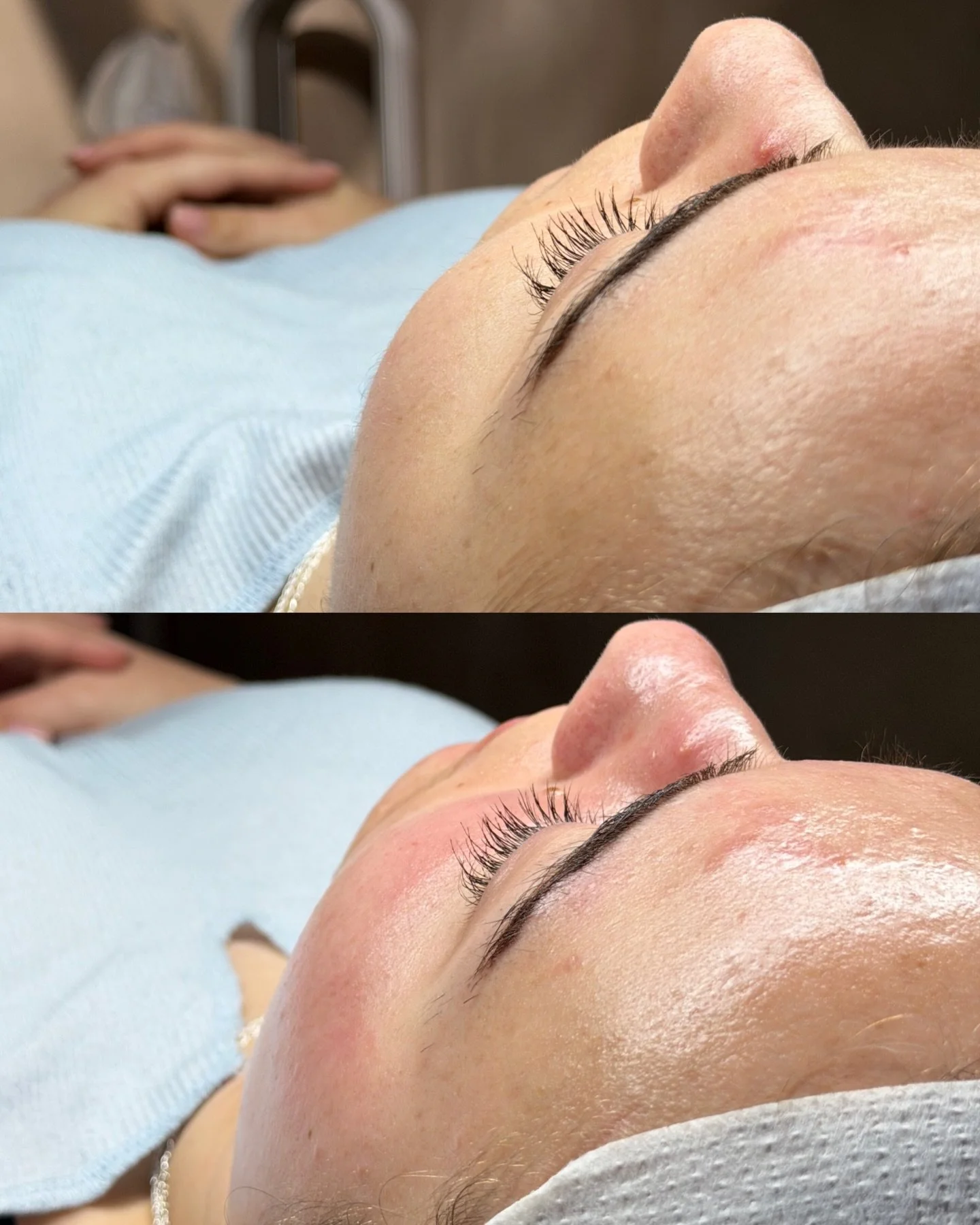 | THE BLOSSOM BOOST | 

Our newest, must have spring treatment, that all of our clients are currently raving about!😍

🧖🏻&zwj;♀️ @tiffanychavezbeauty 

📞 717.900.1390 | #BlossomYork