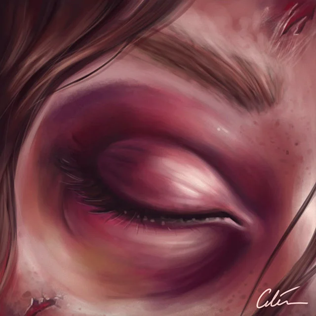 5 signs of a base of skull fracture — artibiotics