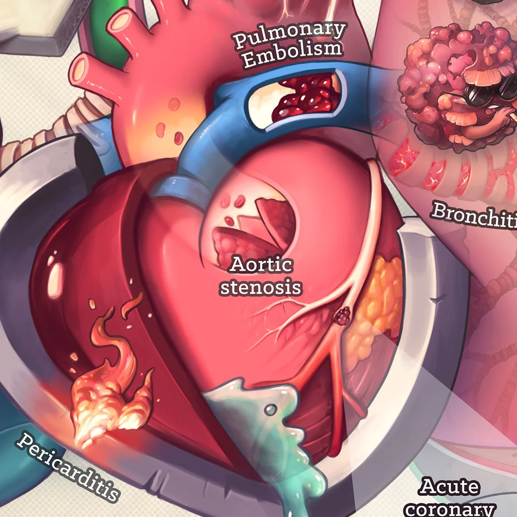 Causes of chest pain CU 03 1024px.jpg