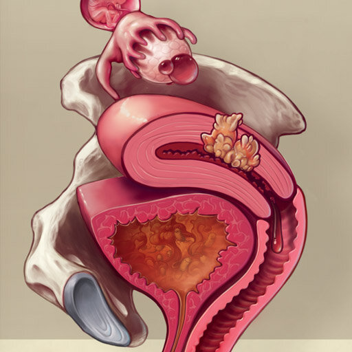 pelvis by dr cilein kearns artibiotics medical illustration.jpg