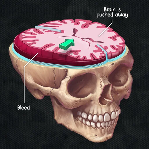 Supporting patient understanding by making pathology tangible
