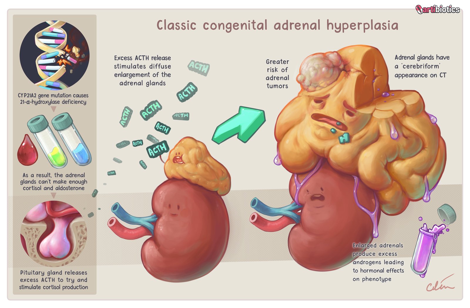 CAH-by-Dr-Cilein-Kearns-Artibiotics-v17-72dpi-1600px.jpg