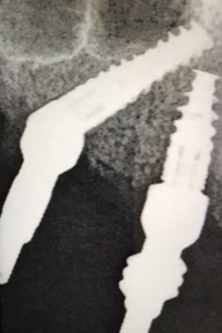 AllOn4XRay1.png
