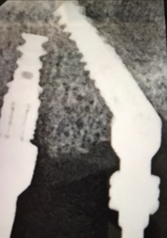 AllOn4XRay2.png