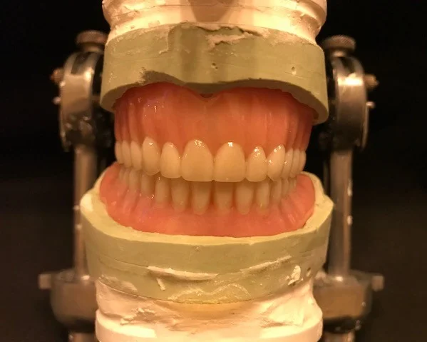DentureFinal.jpg