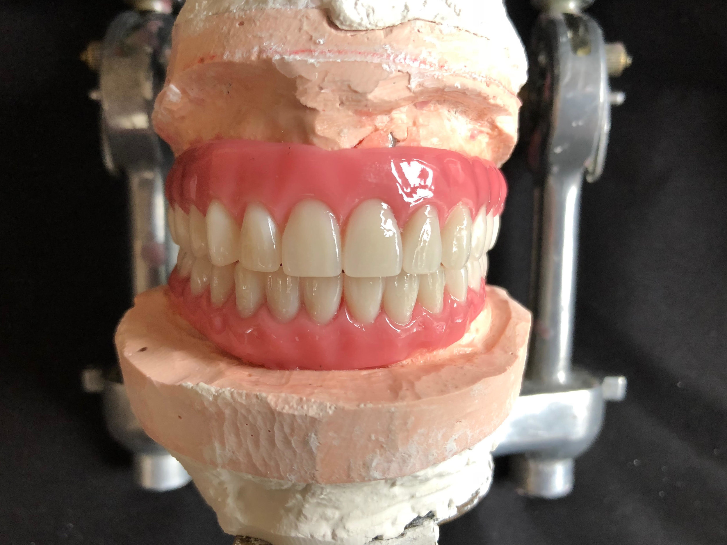 PIB Wax-up1.jpg