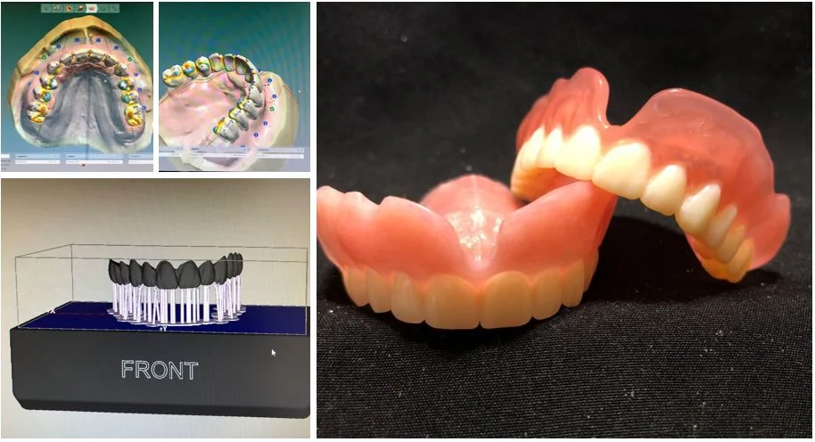 3Shape Scanner and Design Software from Zahn