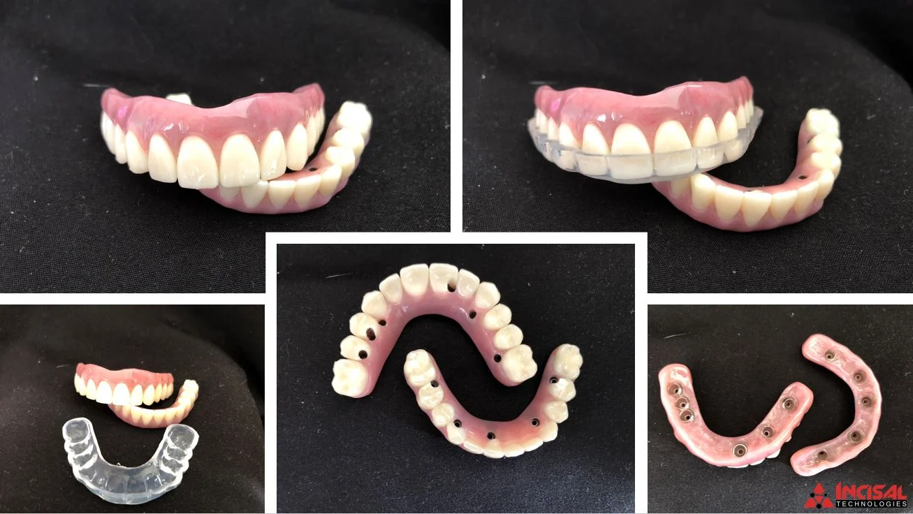 Another All-on-X Hybrid