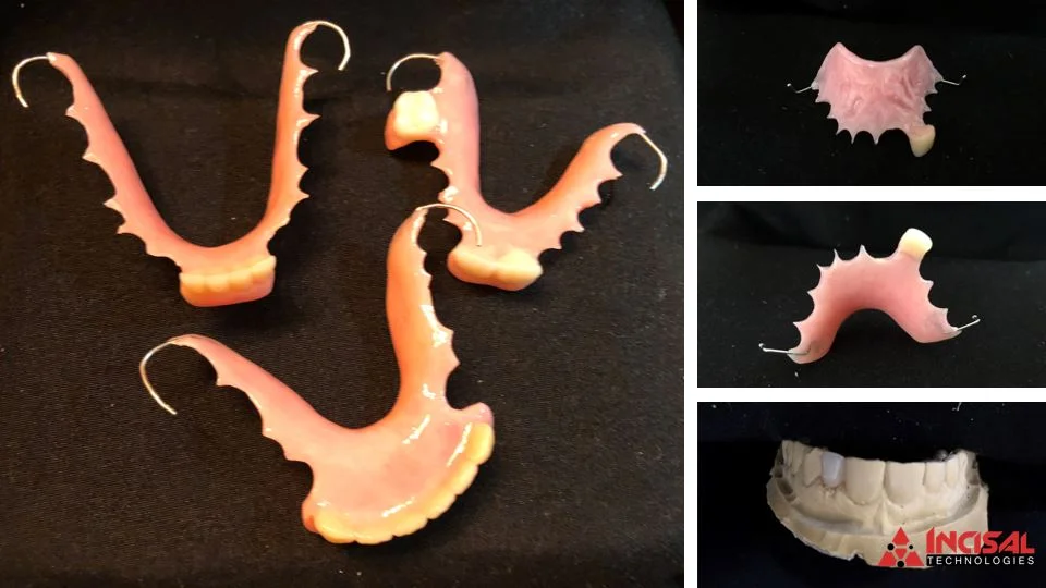 Flippers - A Necessary Evil or Underrated Treatment?