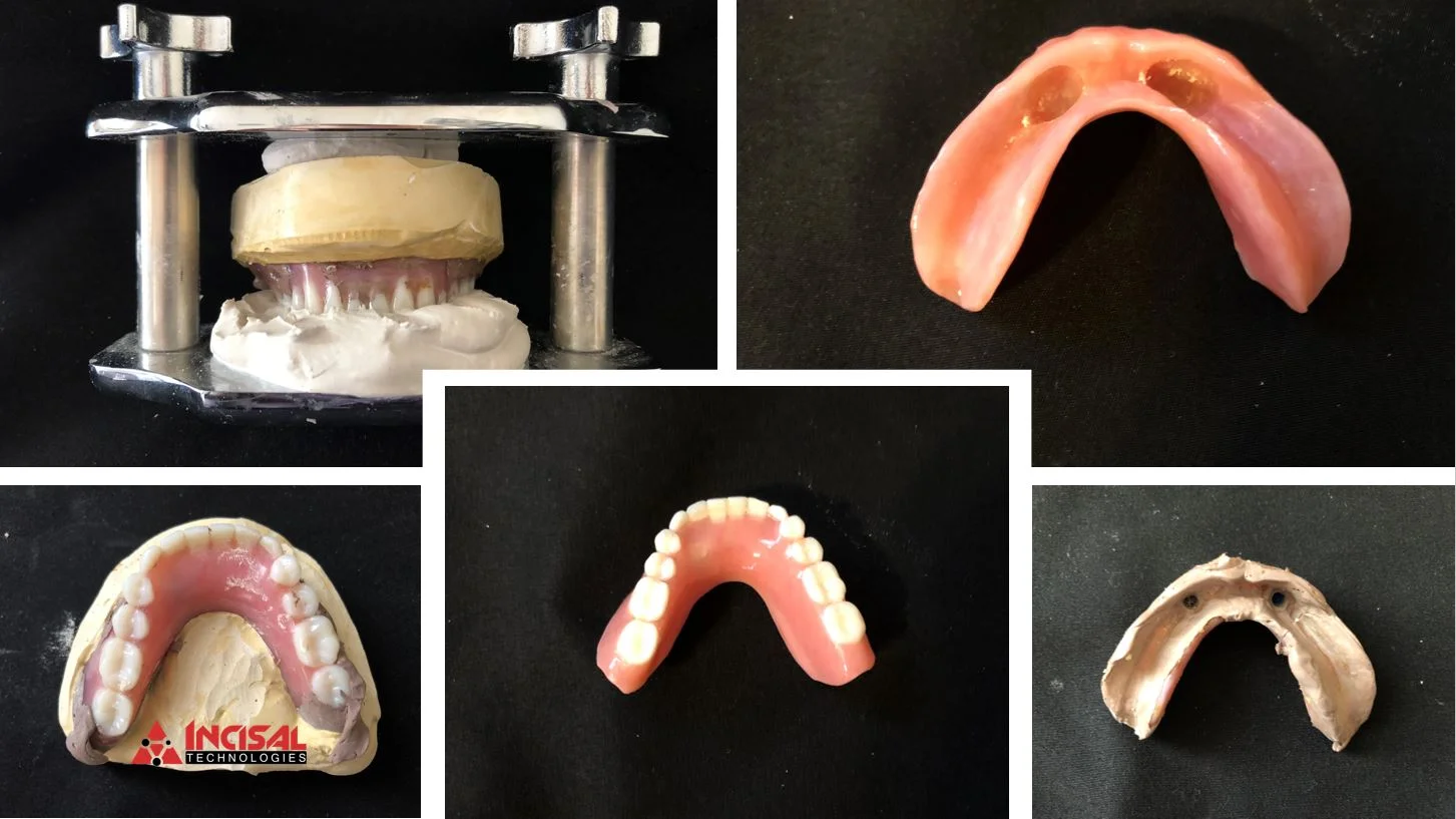 Who wants to do denture relines or repairs? We do!