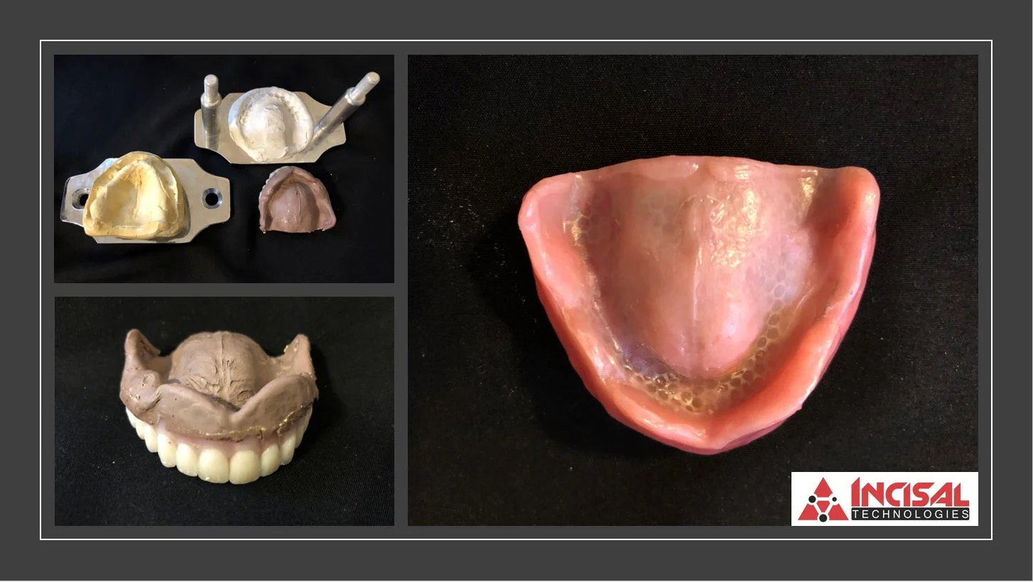 What Lab Wants To Do Denture Relines or Repairs? We Do (Part 2)!