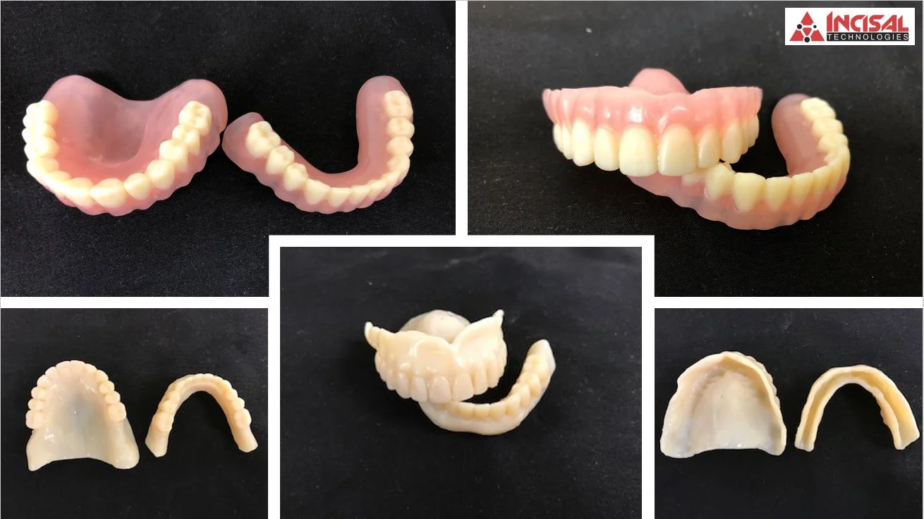 Kulzer Kara Print 4.0 - More Production From Our 3D Printer