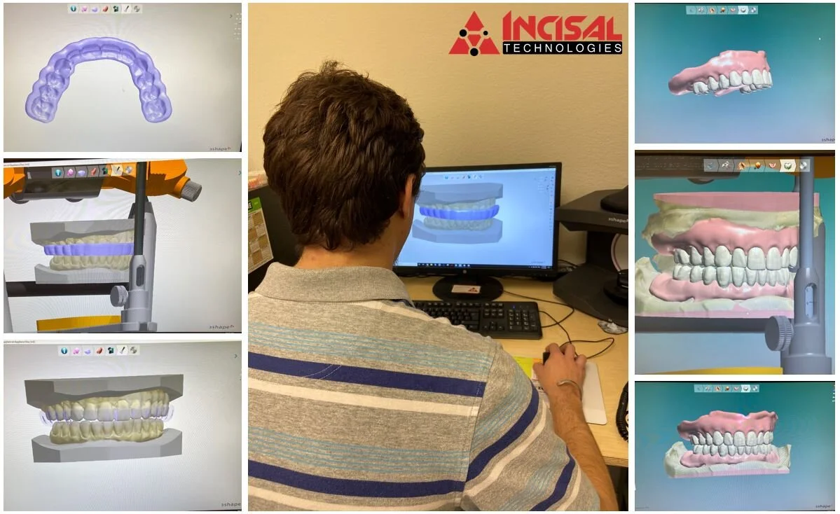 Digital Denture Design For 3D Printing