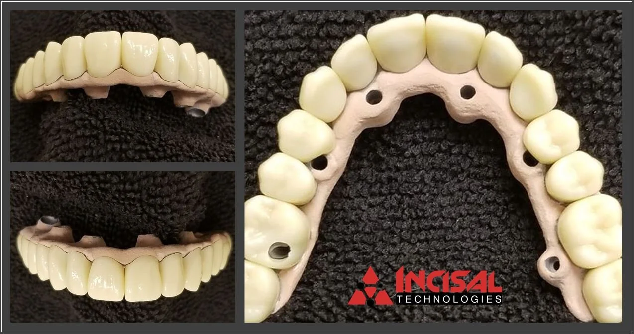 Hybrid Coping Bridge