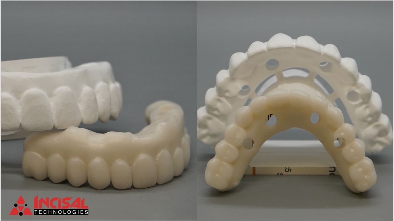 Solid Zirconia Hybrid Arches
