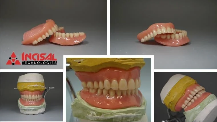 Acrylic Dentures