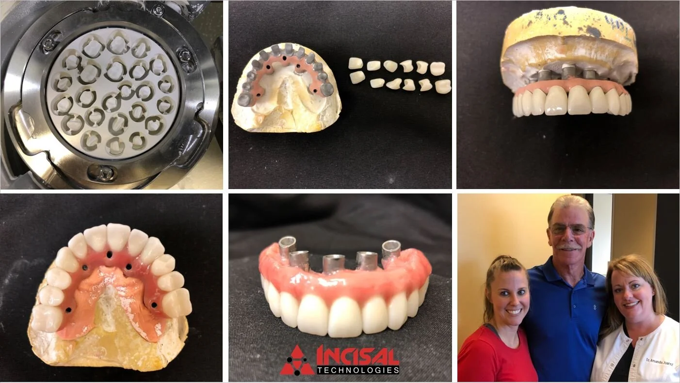 Travelling all-on-4 conversion services!