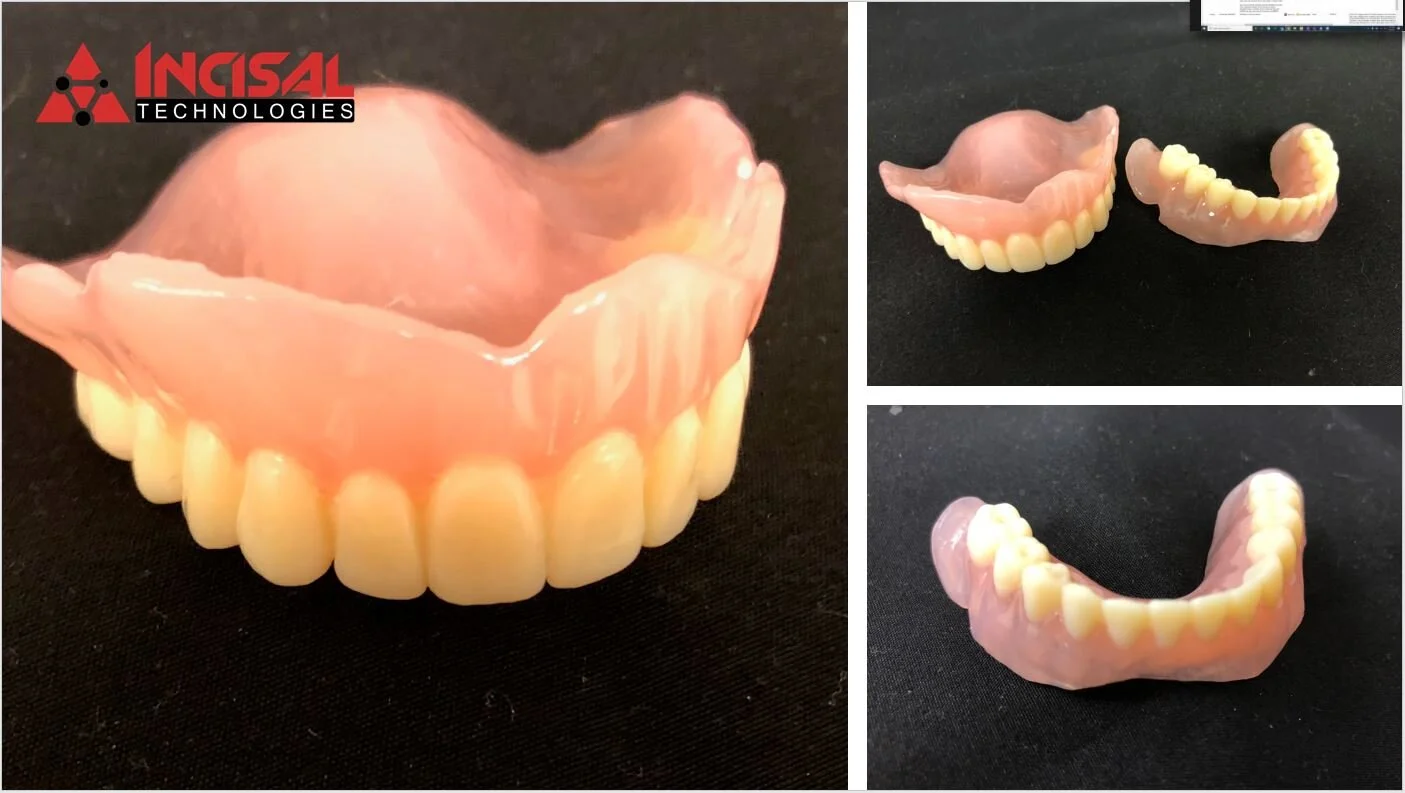 3D Printed Dentures - cara Print 4.0