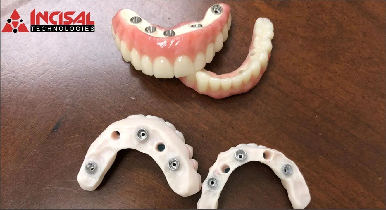 Crystal Ultra Hybrid Dentures