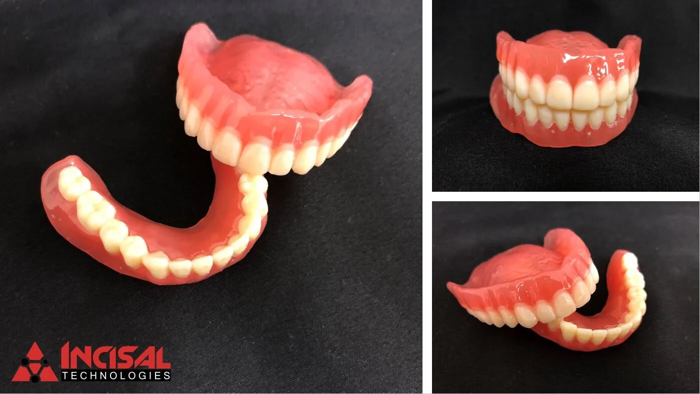 cara Print 4.0 - 3D Printed Dentures
