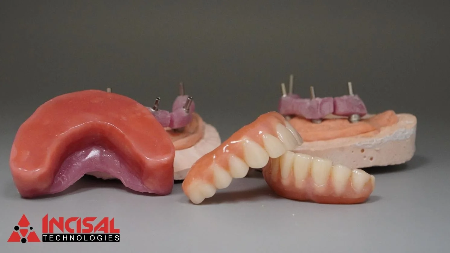 Components to All-on-4 Upgrade