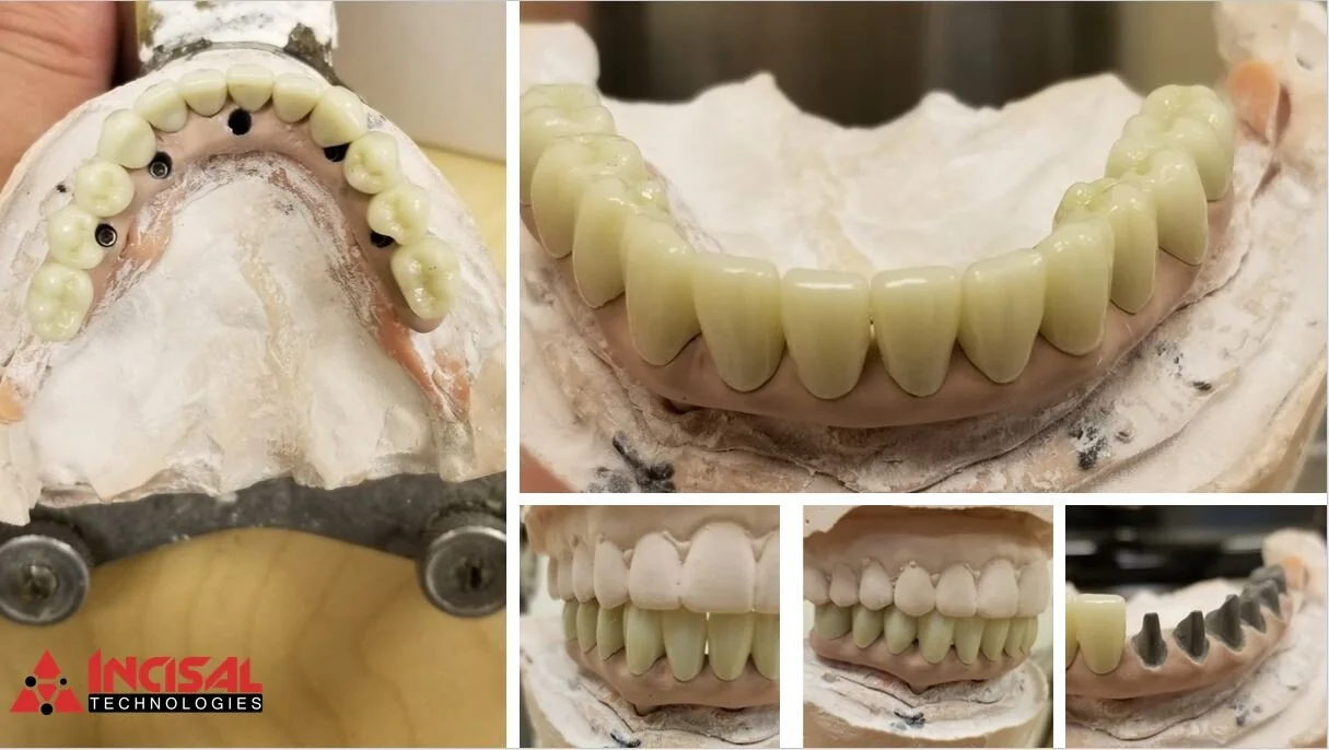 Hybrid Coping Bridge in Process