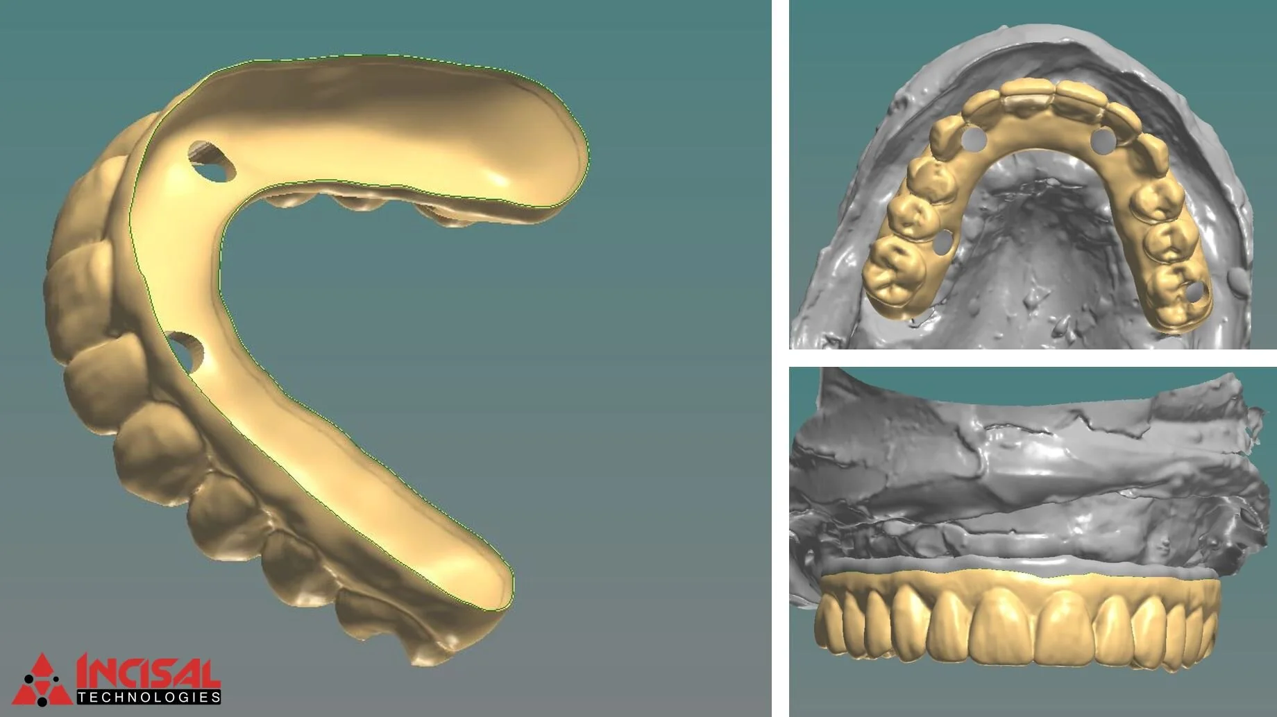 Designing a Crystal Ultra Hybrid Arch Over a Tri-Lor Bar