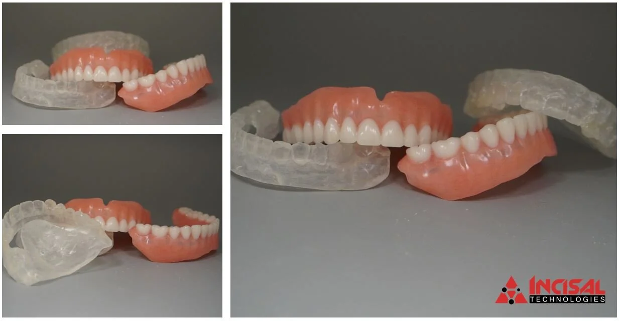 Temporary Dentures and Bone Reduction Guides