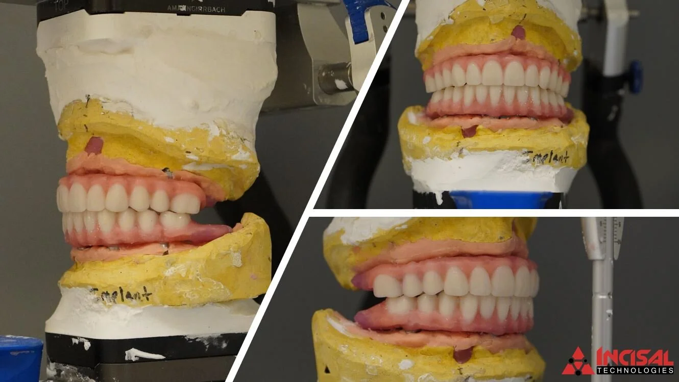 Another All-On-4 Wax Try-In