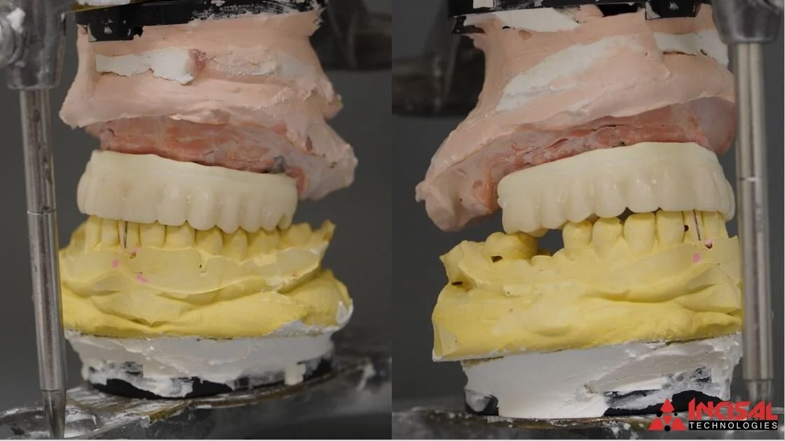 Milled Crystal Ultra Upper Hybrid