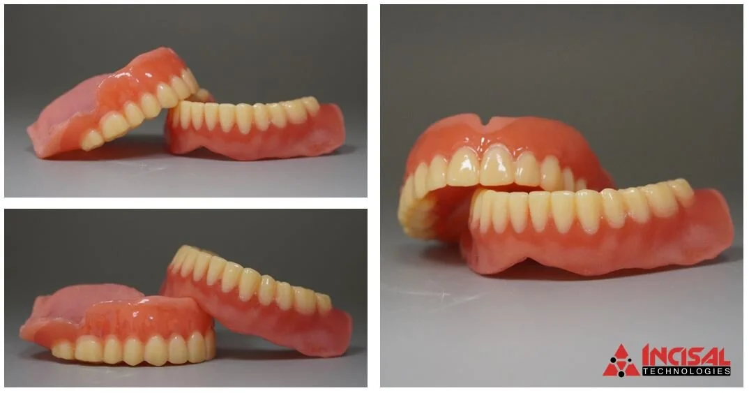 3D Printed Dentures and Reline