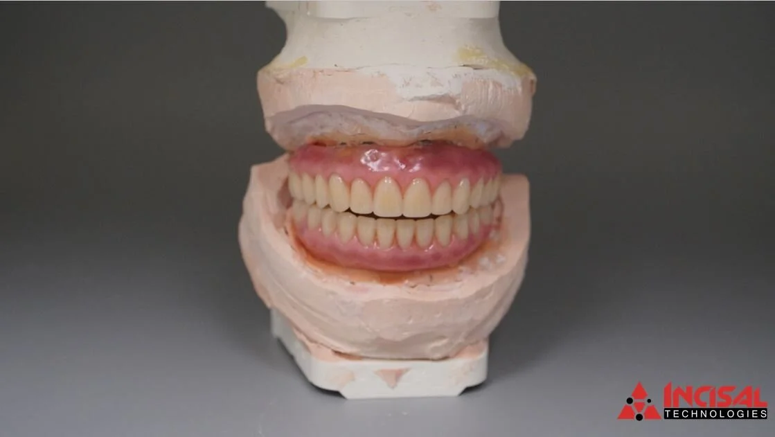 Wax Try-In for Another All-on-4