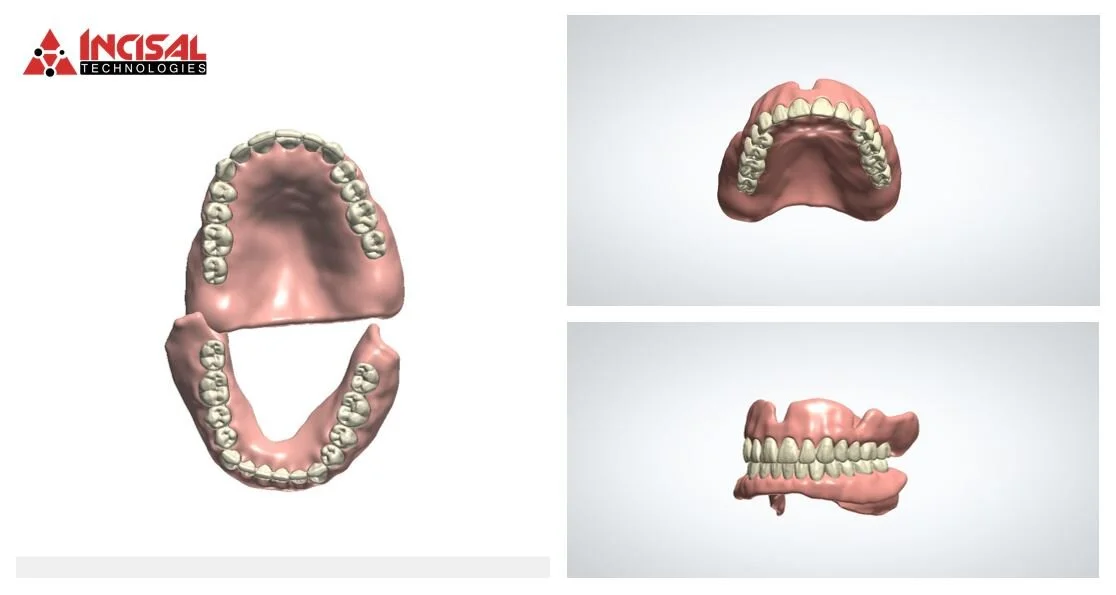 Pala Digital Dentures