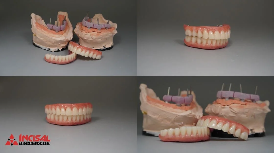 Wax Try-In and Verification Jigs