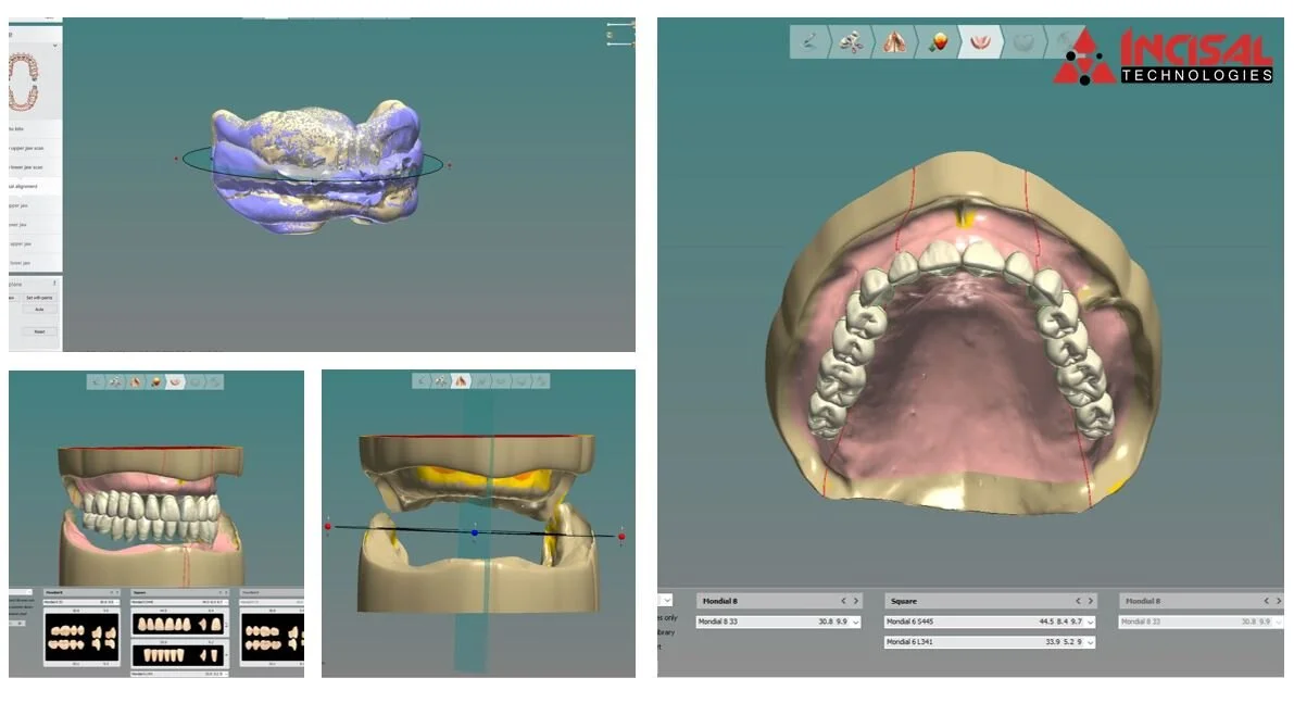 Digital Impression Delivery