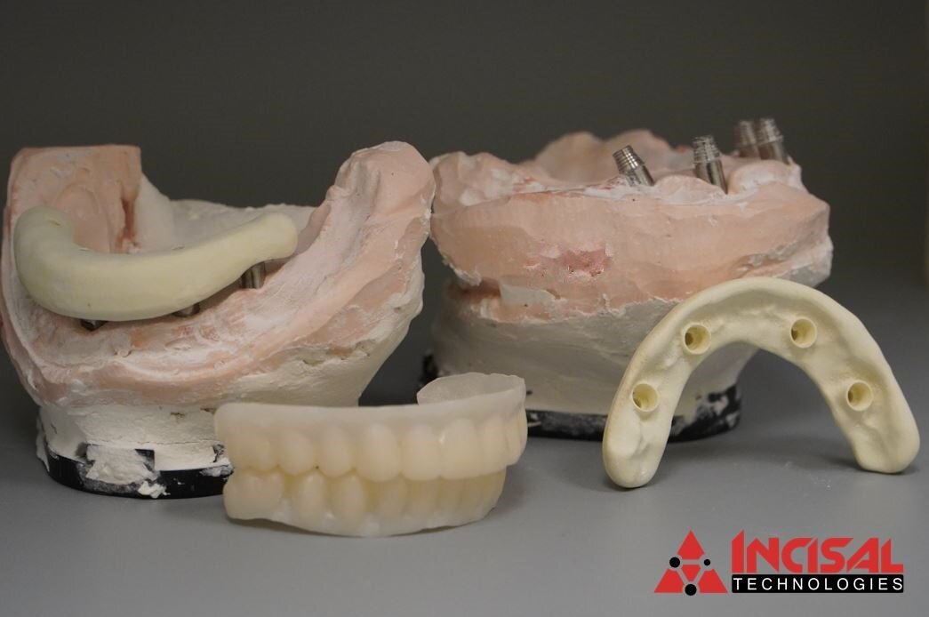 Upper and Lower Crystal Ultra in Process